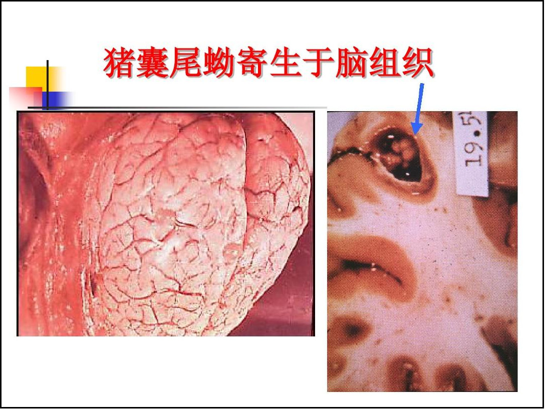 体内怪物 大脑生蛆图片