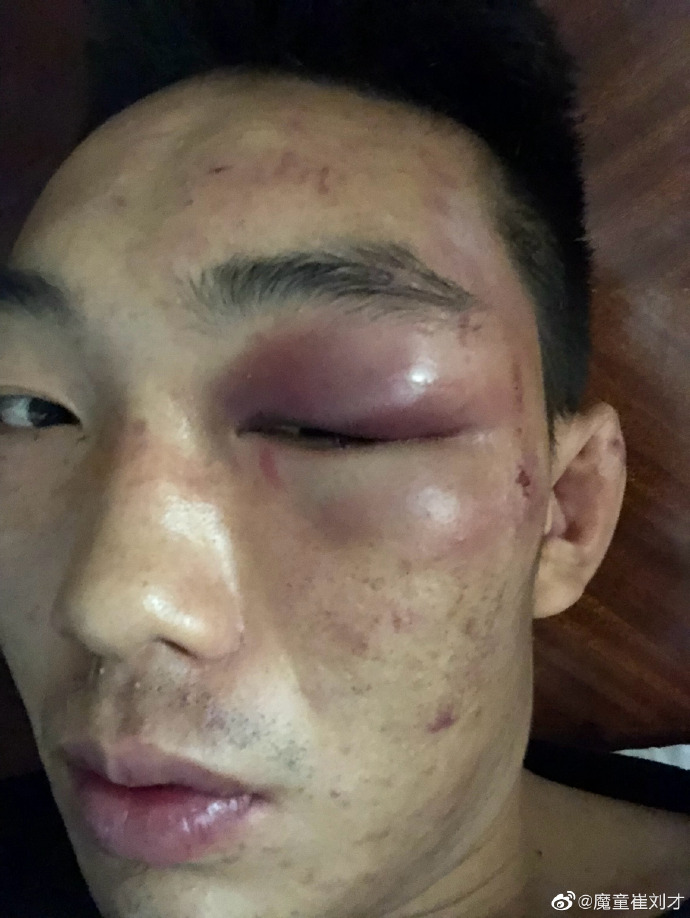 "魔童"崔刘才突然自发声明退出拳台,其中似乎隐藏复杂蹊跷原因