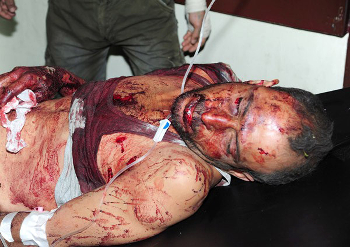 一名男子因邻居小孩吵闹而采取了暴力砍伤的行为,导致一家三口受伤