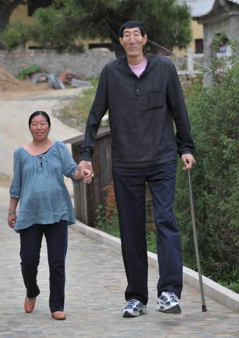 巨人身高2.36米,脚长0.38米,做身衣服是一般人需要布料的两倍!