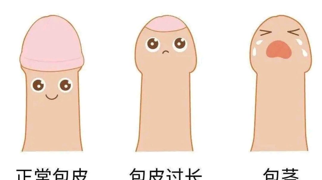 成人包皮吻合器术后注意事项