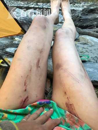 36岁知名比基尼登山客坠崖身亡:4年已换过97套