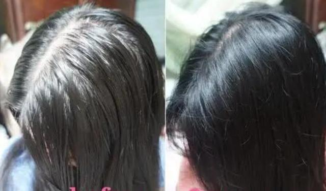 头发出油扁塌无光泽?这款氨基酸洗发水助你头发蓬松又顺滑!