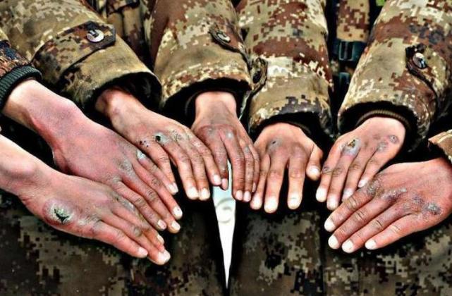 解放军零下40度站岗! 手脚全部冻烂, 为啥不装监控呢?