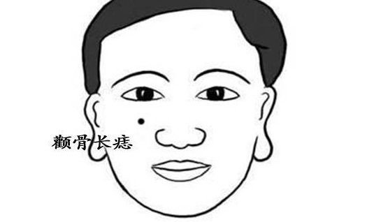 男人此处长痣