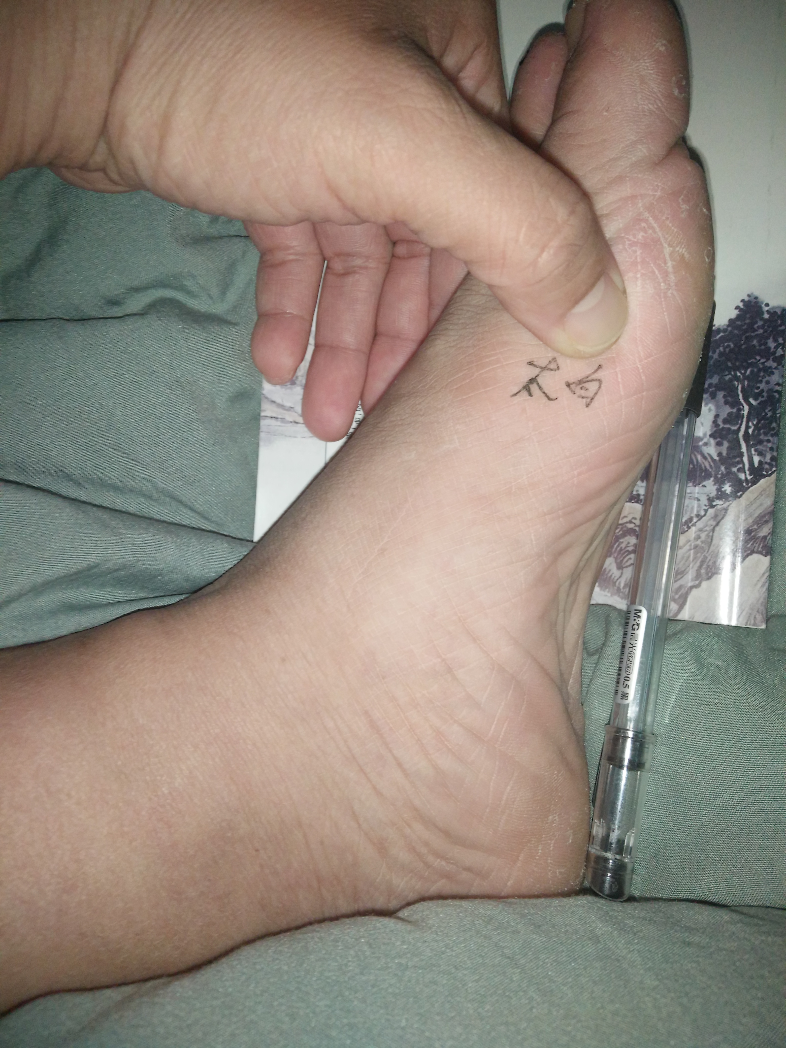 胃疼腹泻如何处理