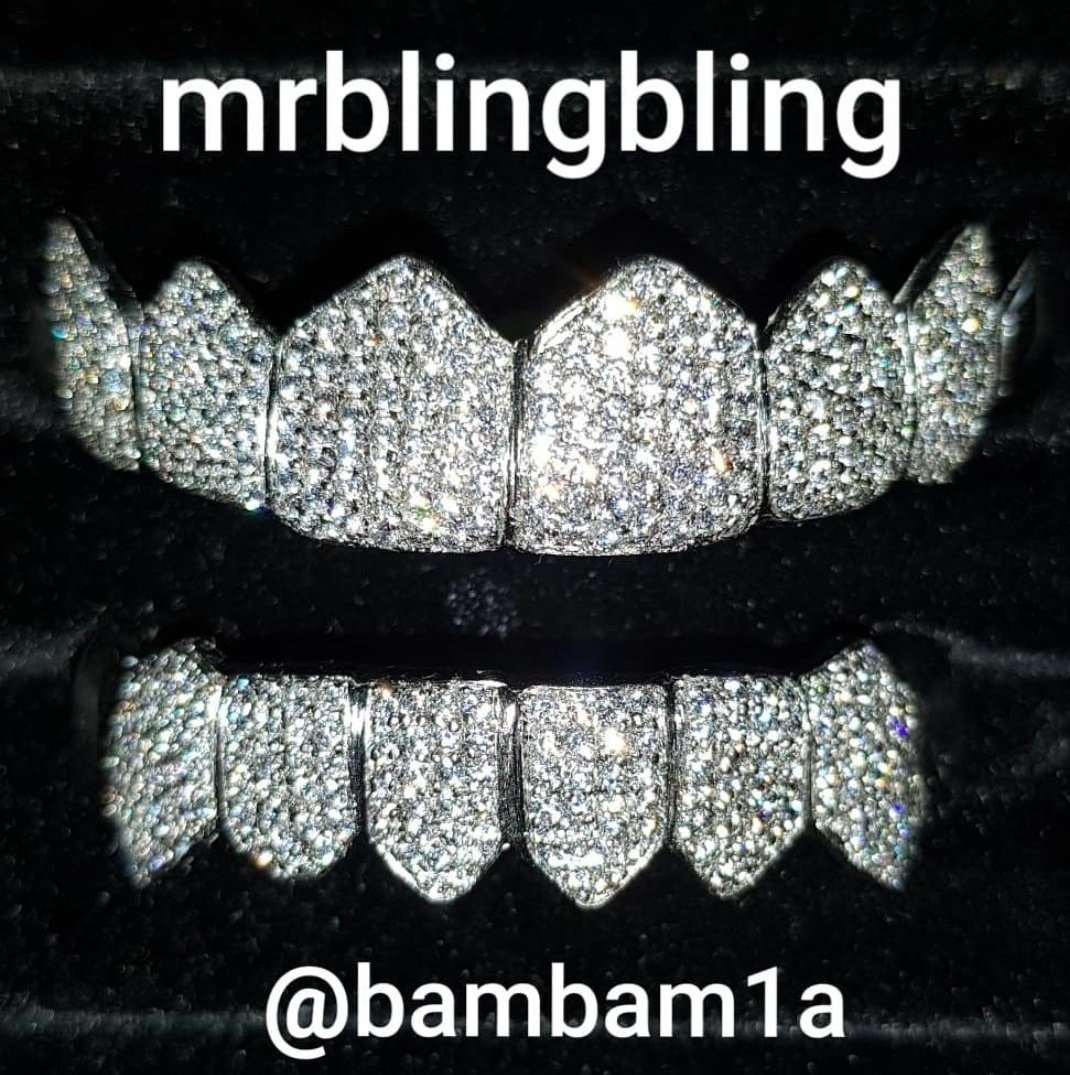 斑米第二套定制镶钻牙诞生 也是相当滴有钱且执着了!
