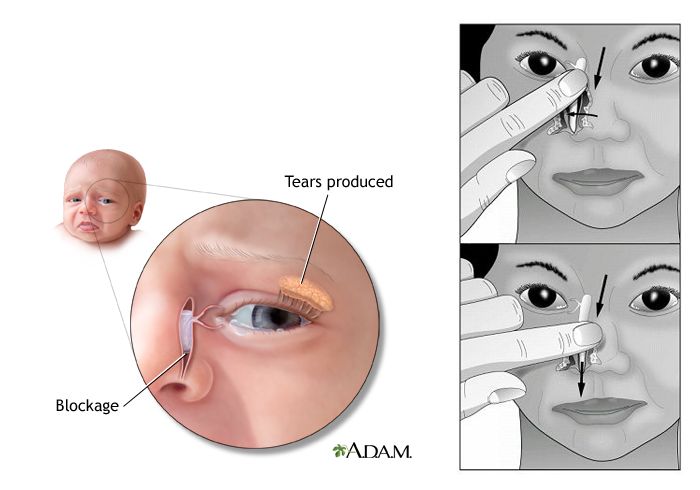 鼻泪管怎么按摩图解图片