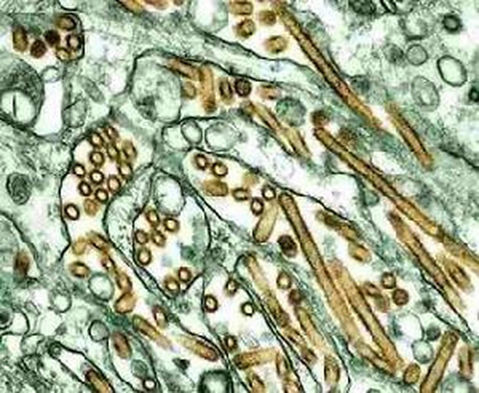 科普知识竞赛#【科普小知识】冷凝集素综合征是指低温时冷凝集素移痧