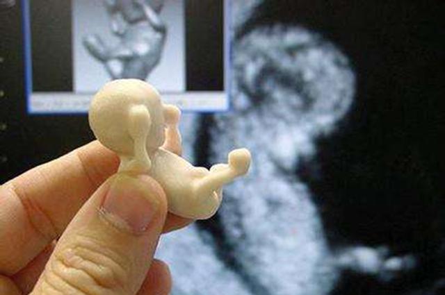 孕十二周真实胎儿图图片
