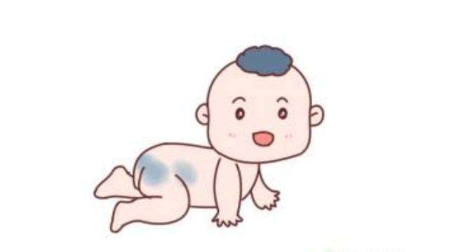 新生儿身上为何会出现淤青?对孩子有什么影响?