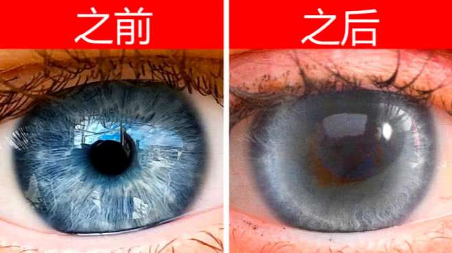 [图]人为什么需要眨眼，假如坚持长时间不眨眼，会发生什么呢？