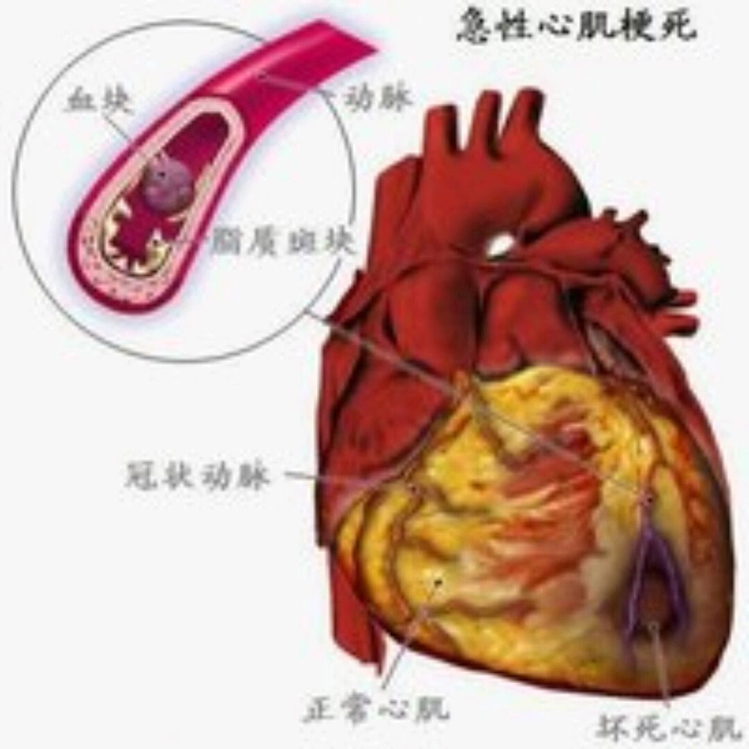 胸痹图片图片