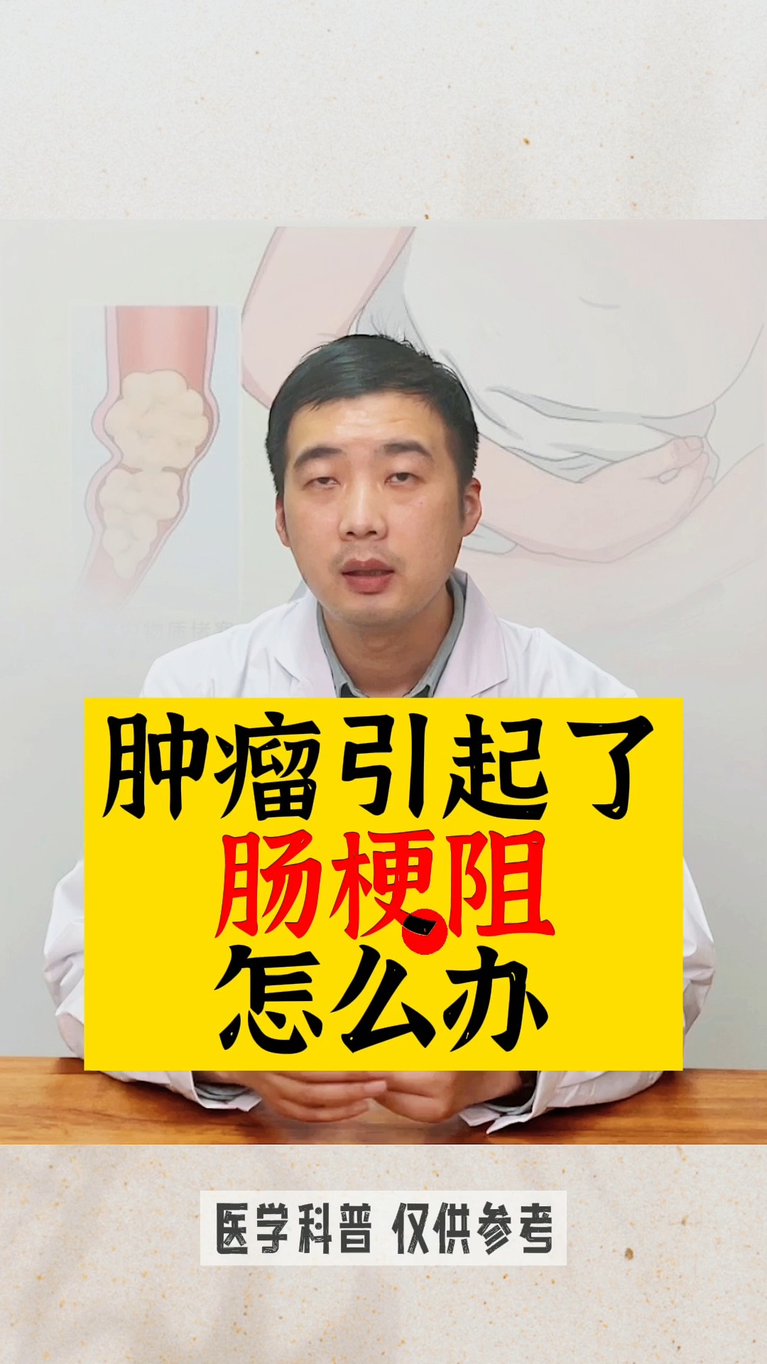 肠梗阻肿瘤引起了肠梗阻怎么办