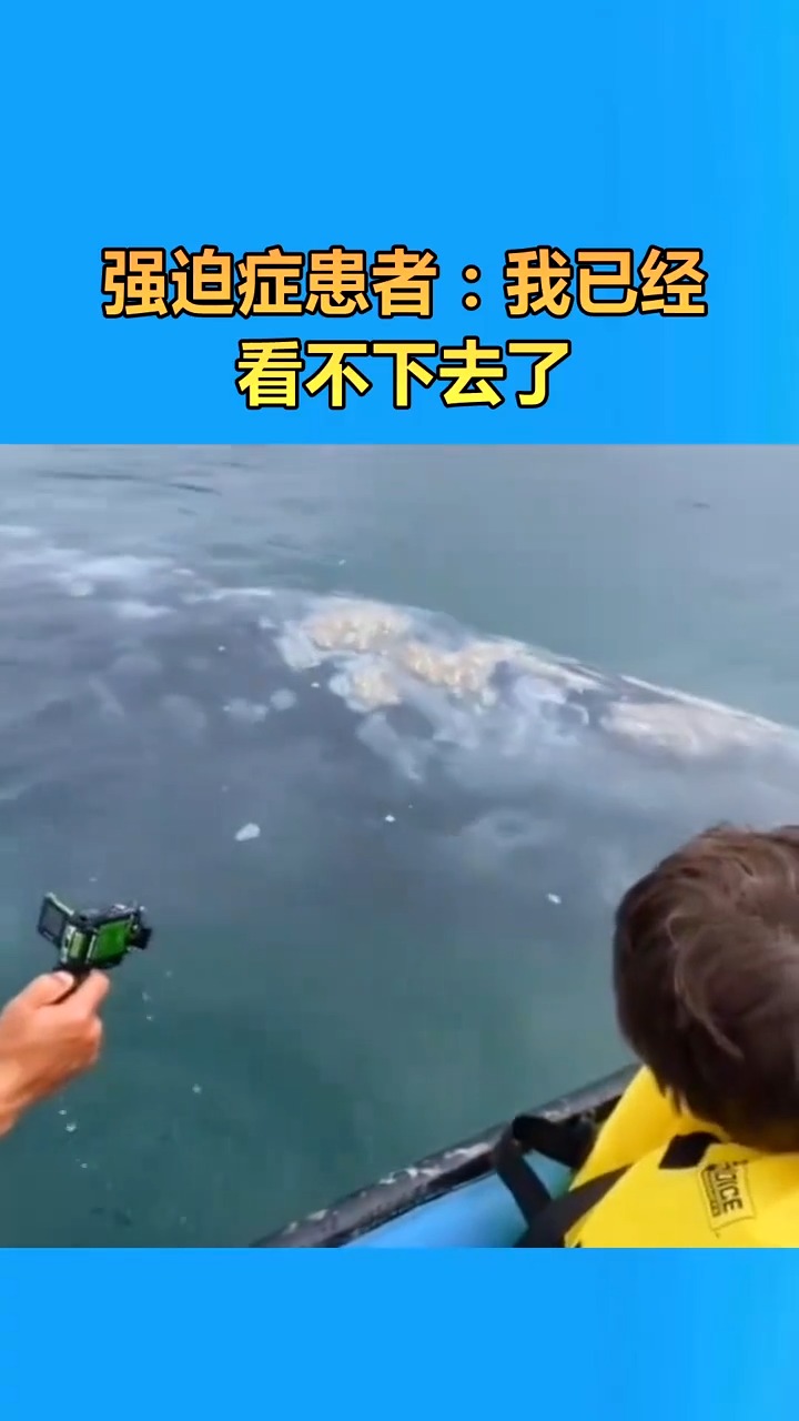 看到鲸鱼身上的藤壶,强迫症患者:我已经看不下去了