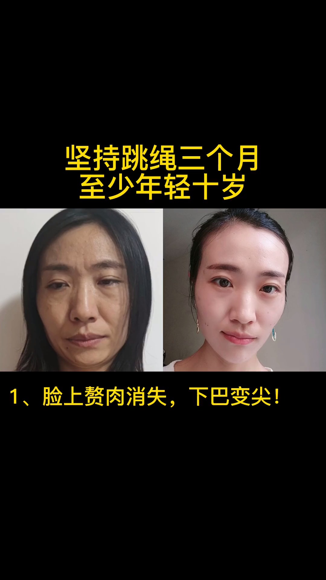 瘦身减肥连我自己也不敢相信跳绳三个月脸部像整容了运动是最好的护肤