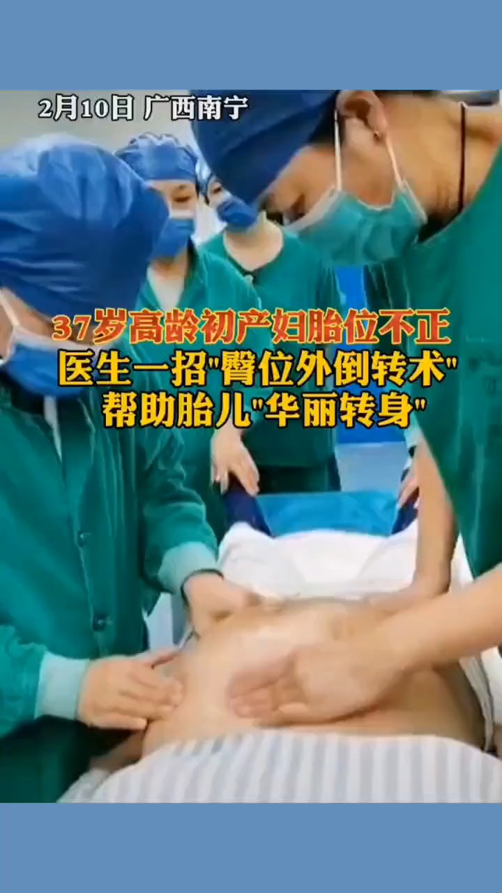 广西南宁,一位37岁初产妇胎位不正,医生一招"臀位外倒转术"帮助胎儿