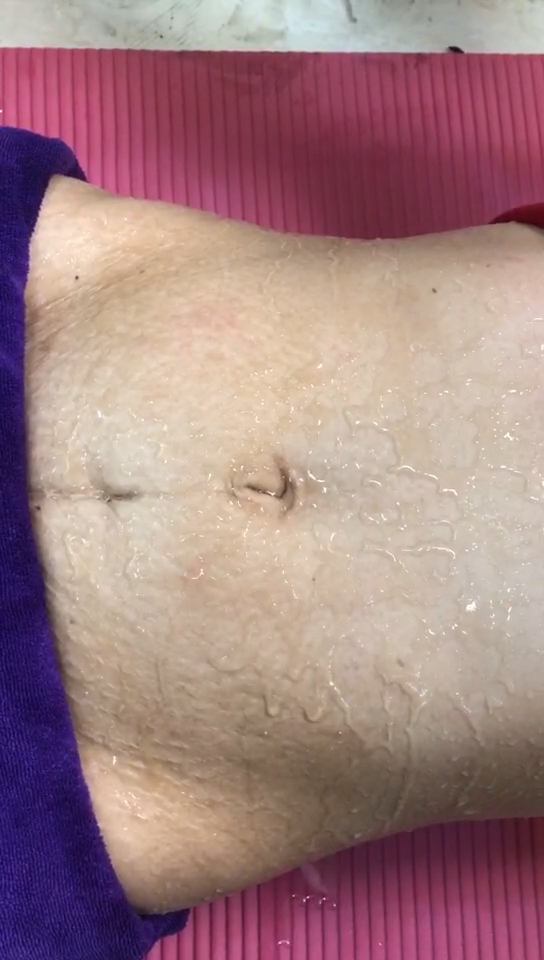 淡化妊娠纹,紧致肌肤.腰围瘦了,还排去湿气