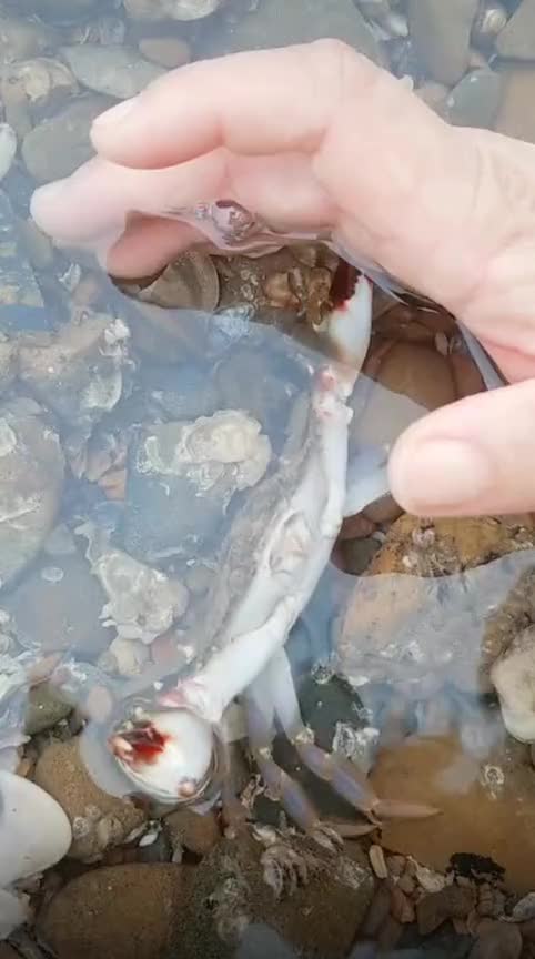 不小心被螃蟹夹到手,朋友非要我如此做,你还有什么妙招吗