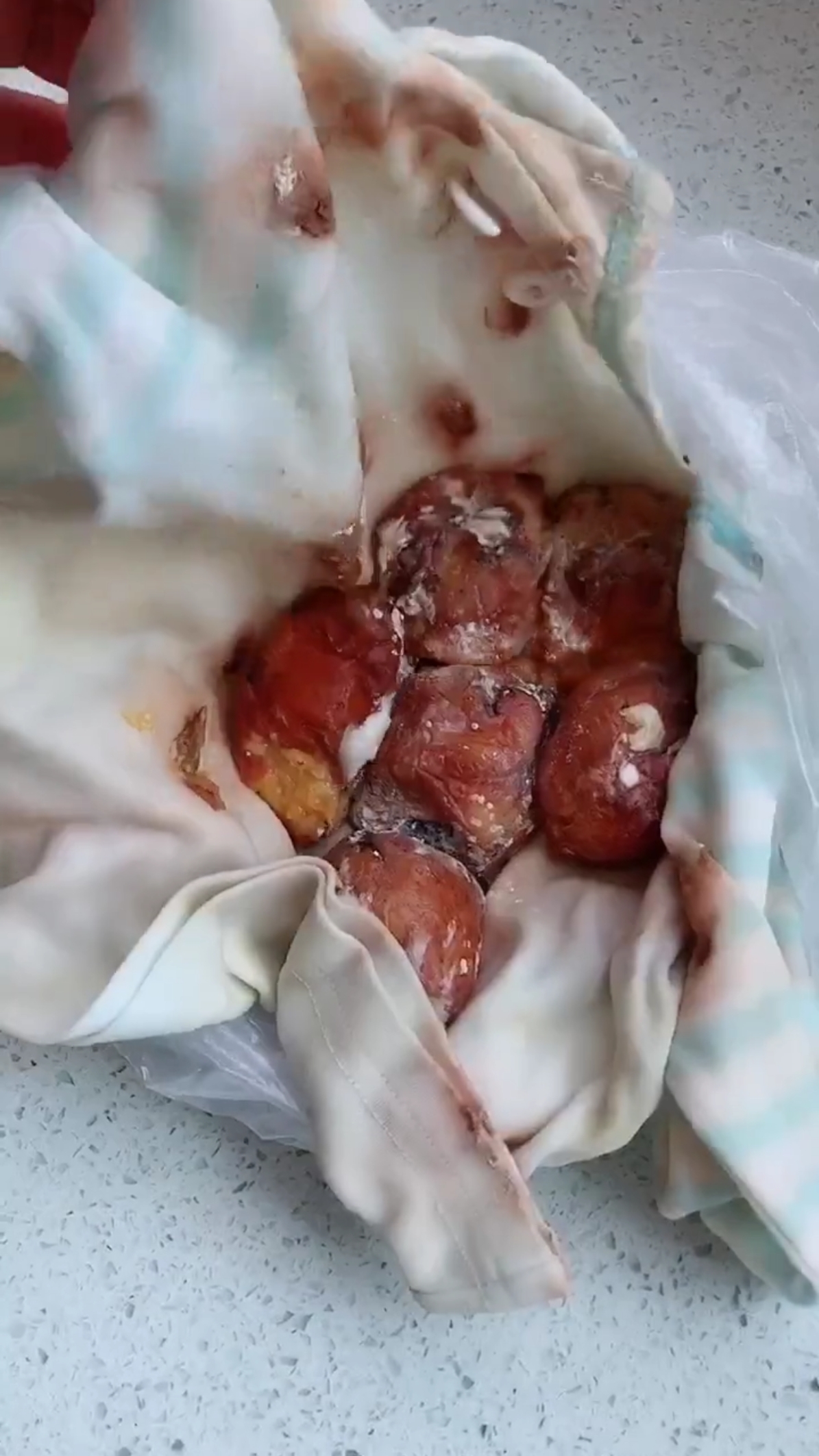 老公说我整天不长脑子,用衣服包的杏子放柜子里烂发霉了