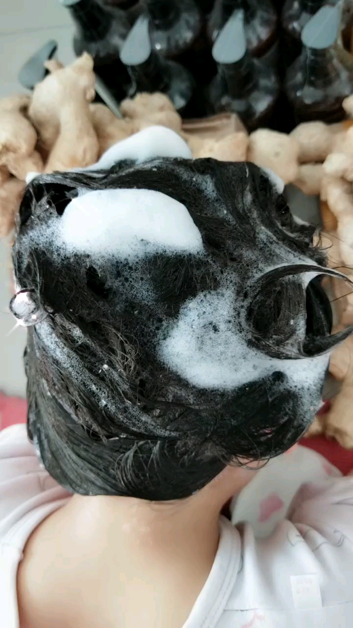 头油,头屑,掉发的近.