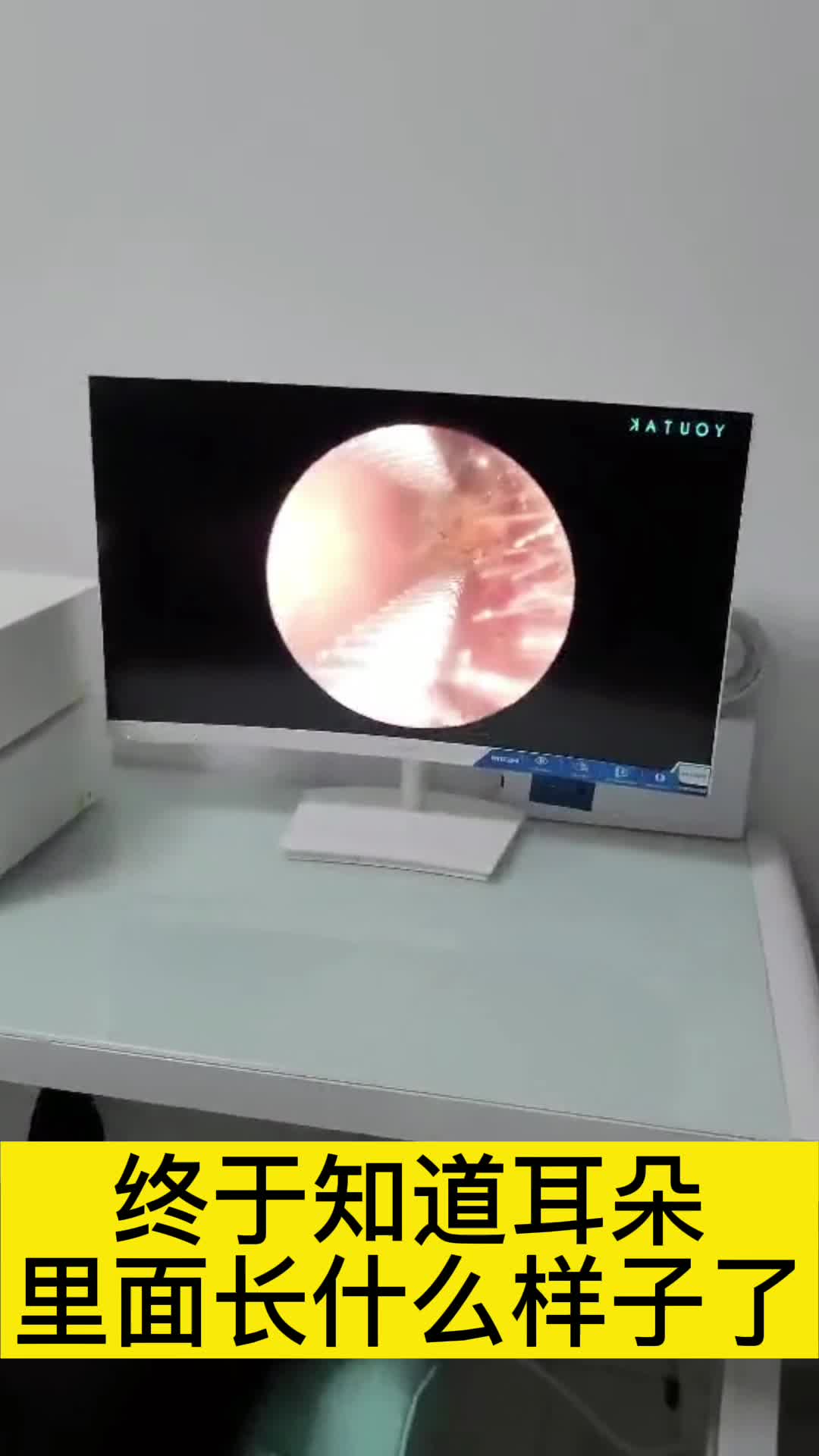 终于知道耳朵里面长什么样子了