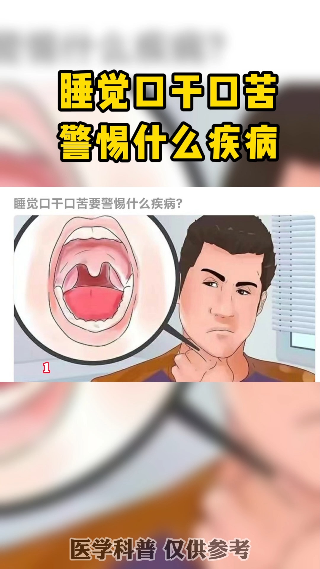 每日健康推荐睡觉口干口苦警惕什么疾病多是这三种引起