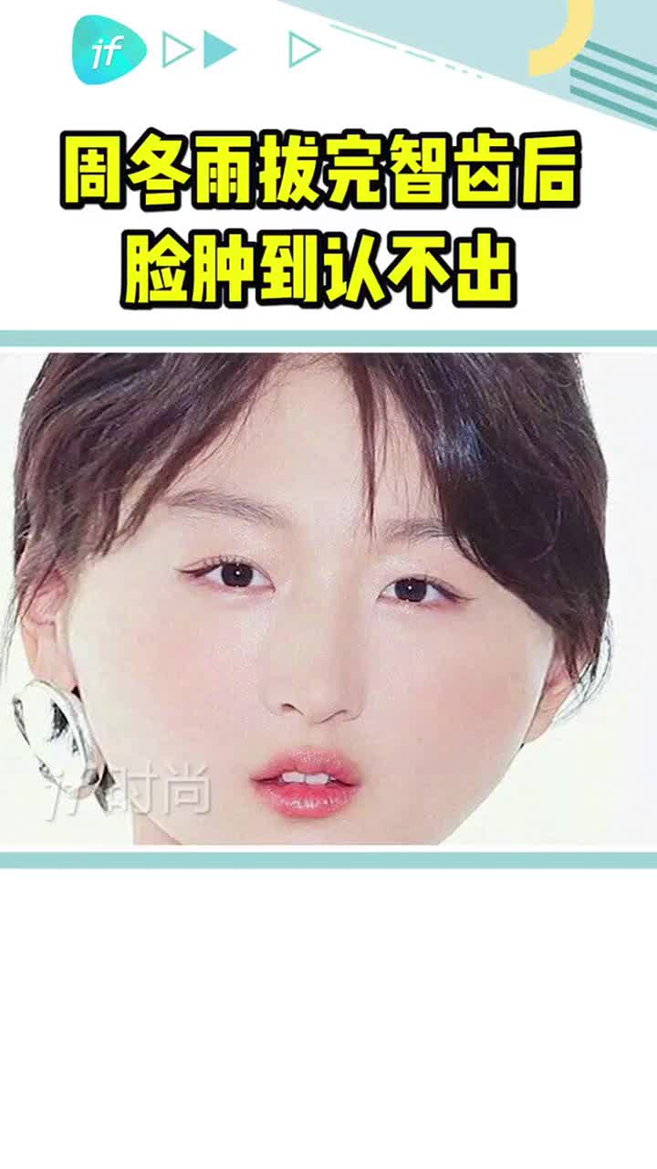 拔完智齿的周冬雨画风太可爱了,虽然脸肿了但是依旧遮挡不住魅力!