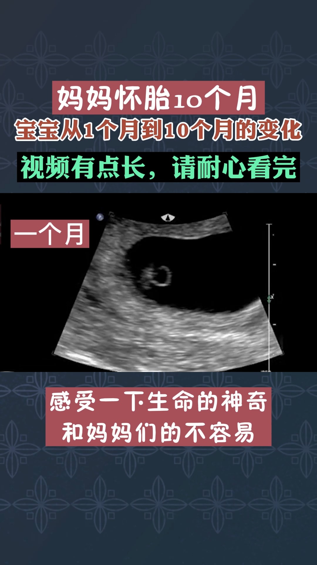 胎儿#怀胎10月 宝宝们都有怎么样的变化.