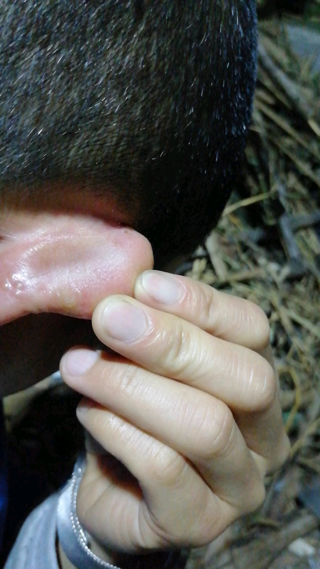 上班21天,天天上班戴口罩,耳朵都给戴烂了.