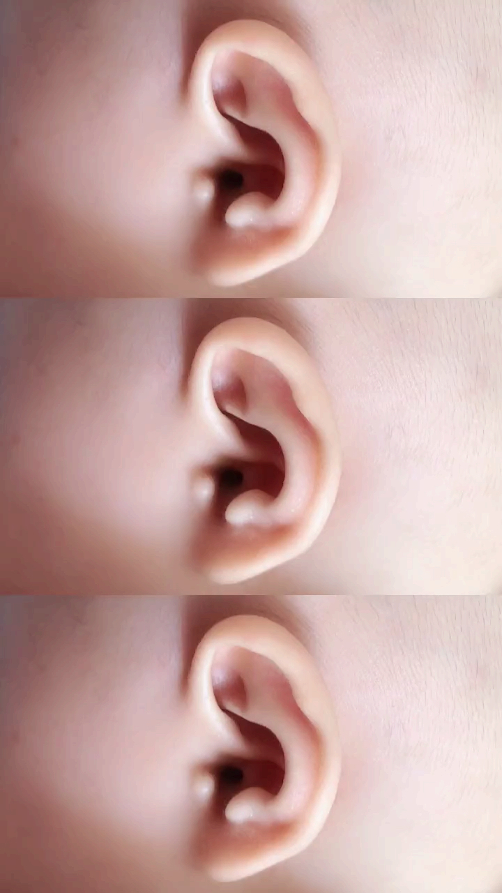 典型的元宝耳朵图片图片