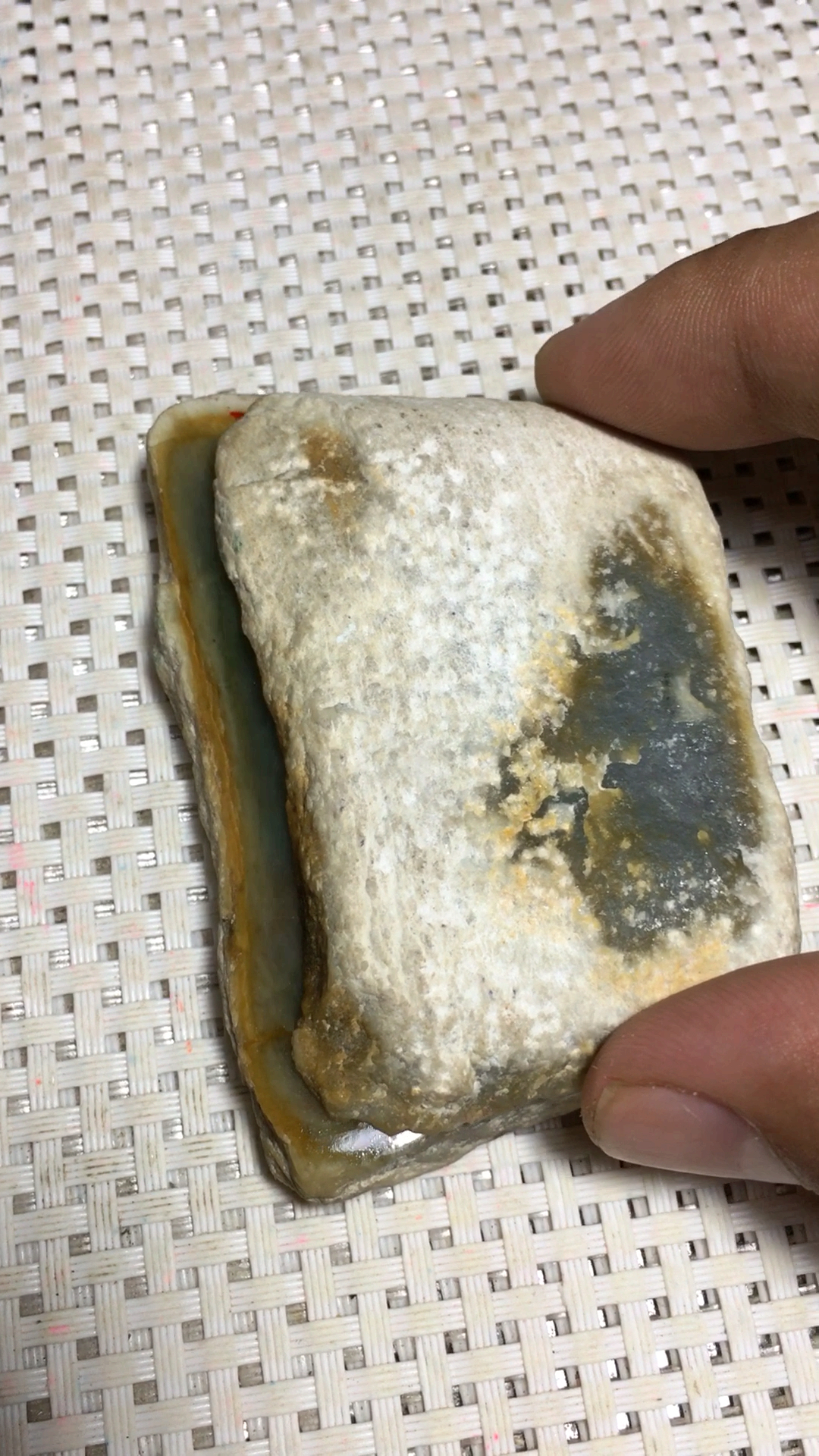 莫西沙水泥皮切开的效果.