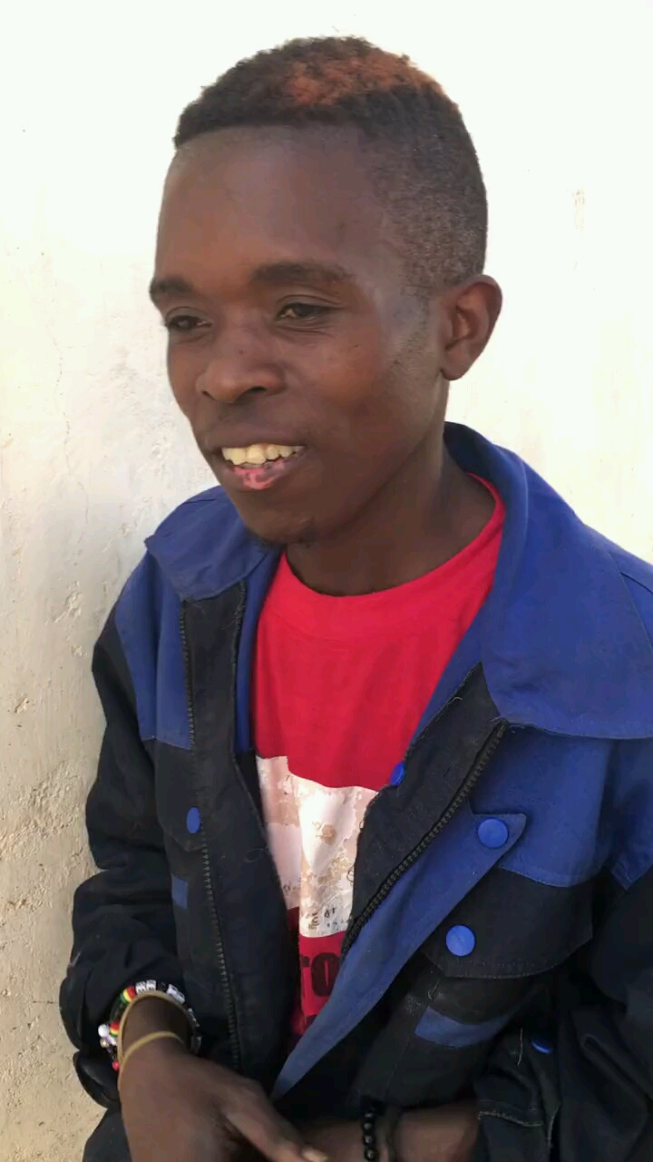 第一次看见黑人得了白癜风的,嘴皮上已经在开始蔓延