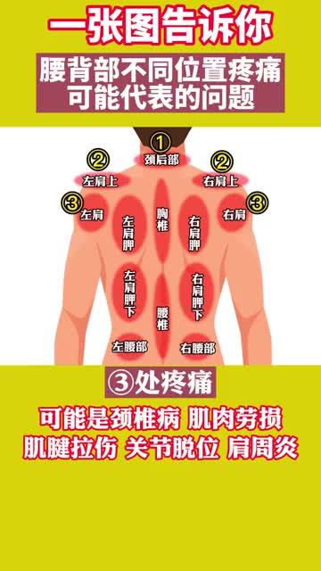 後背不同位置疼痛,可能疼痛問題不一樣