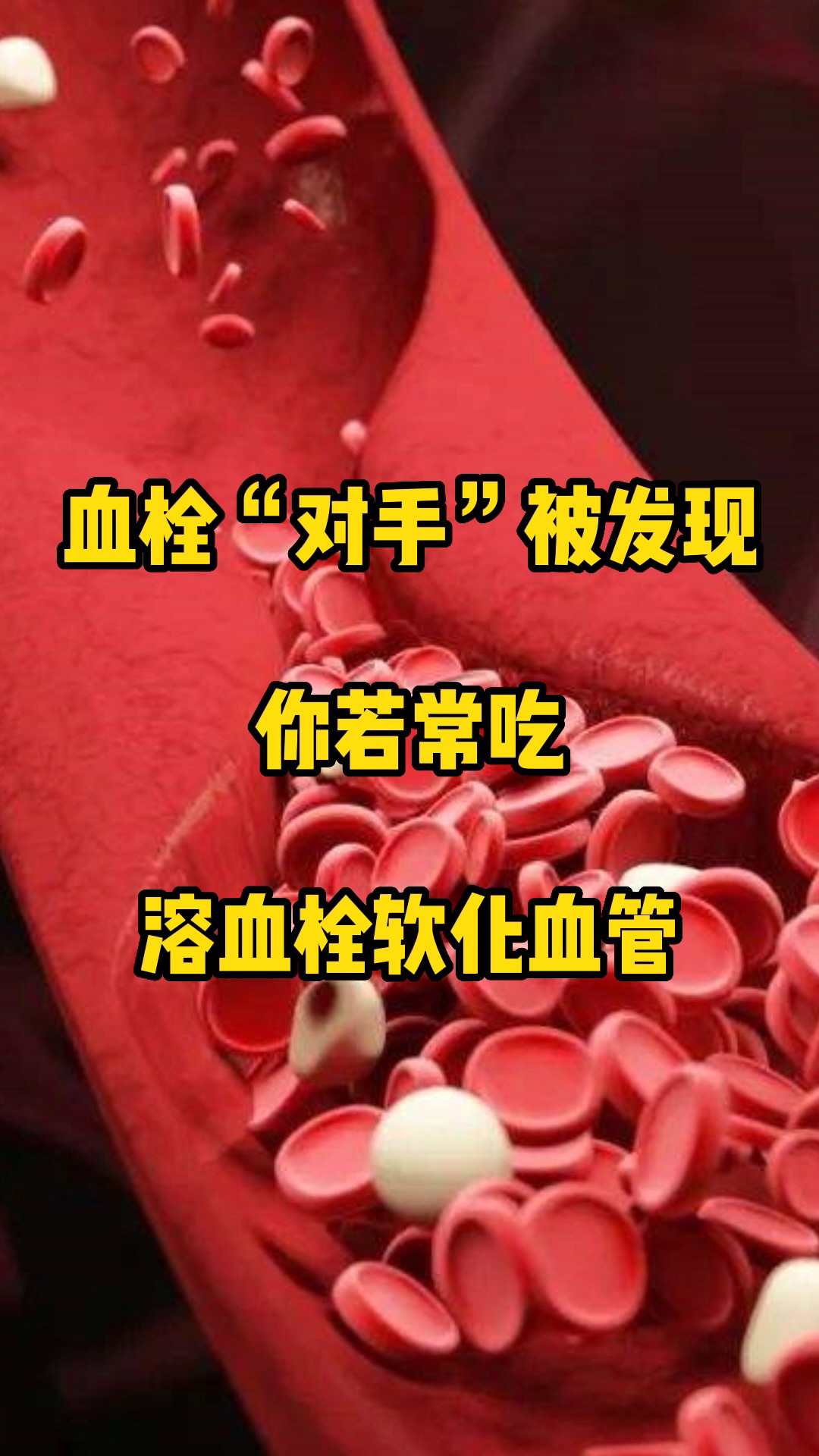 血栓"对手"被发现,你若爱吃,溶血栓软化血管