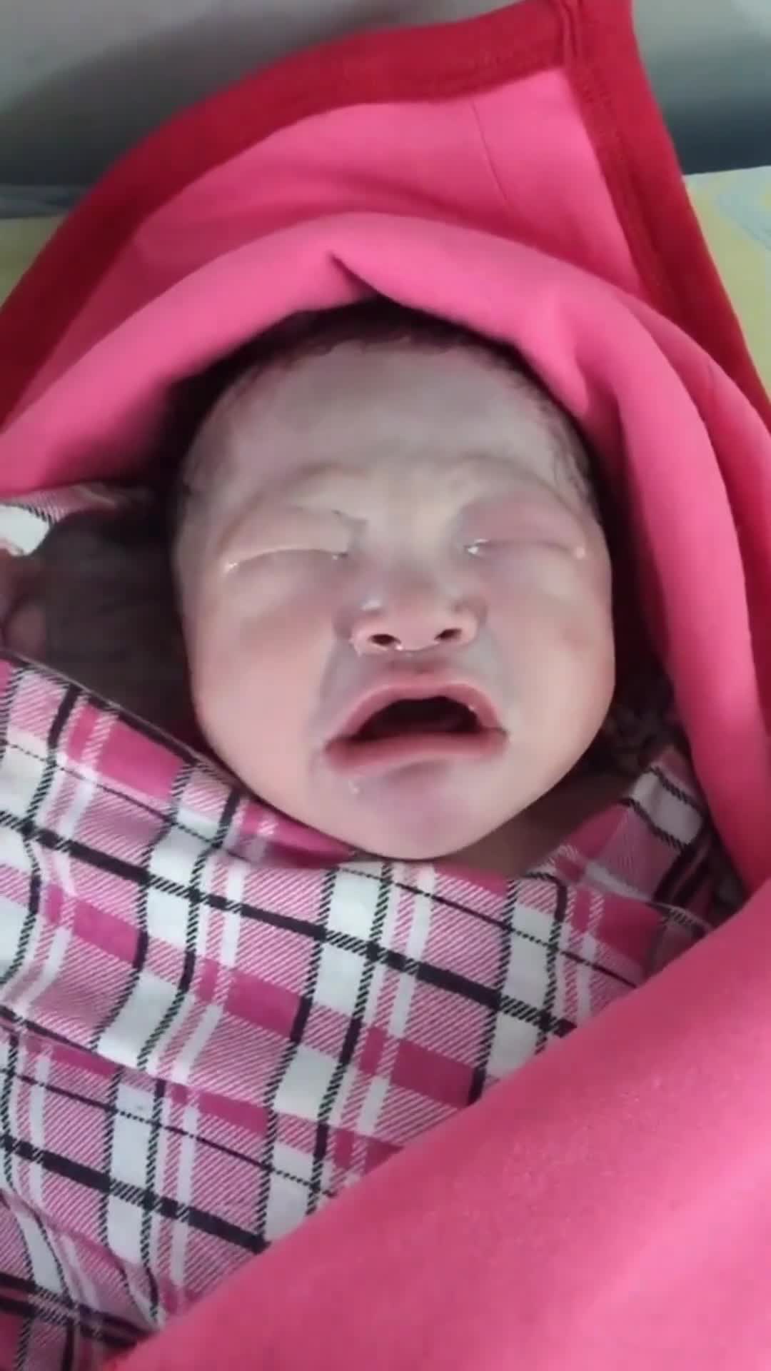 实拍刚出生的宝宝医生说她嘴巴有问题可我没看出来呀