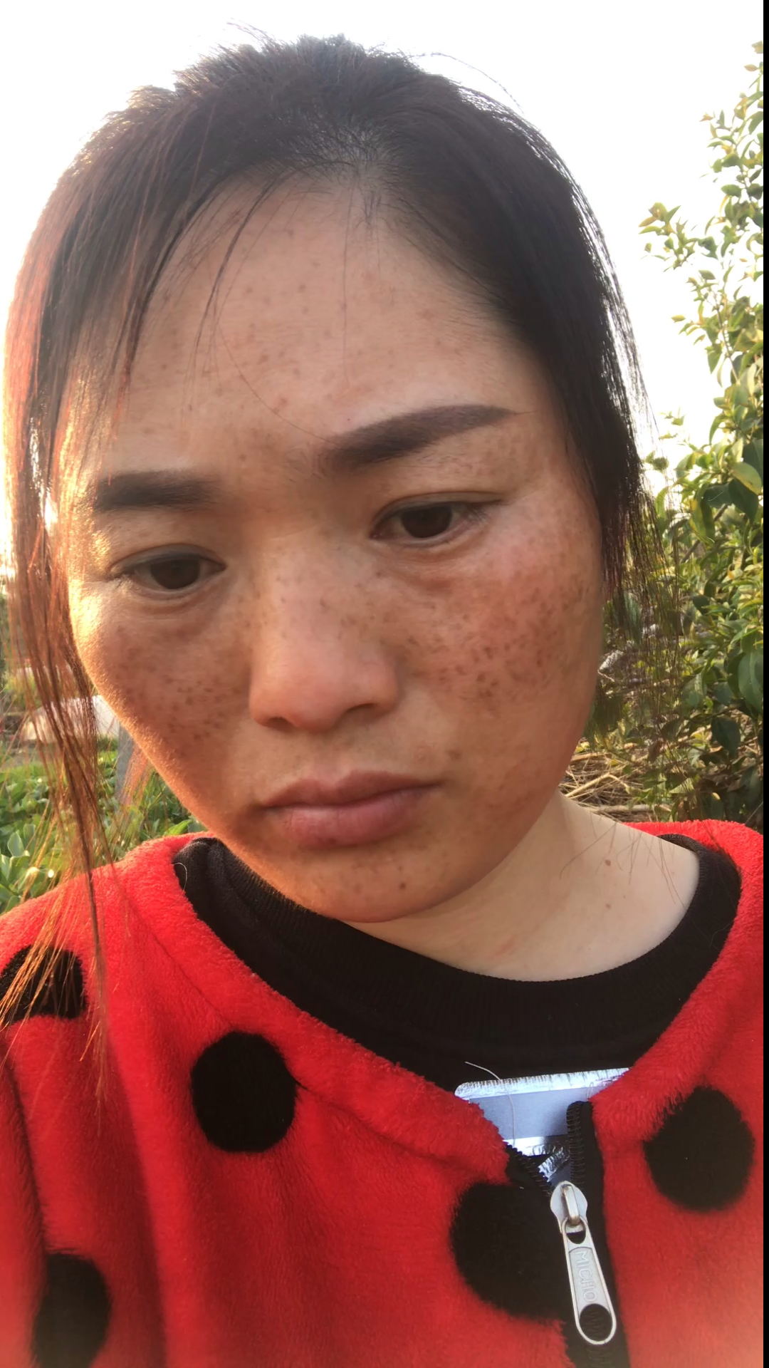 分解黑色素太牛了,皮肤再差都不要放弃,生完孩子满脸的斑,用了它脸上