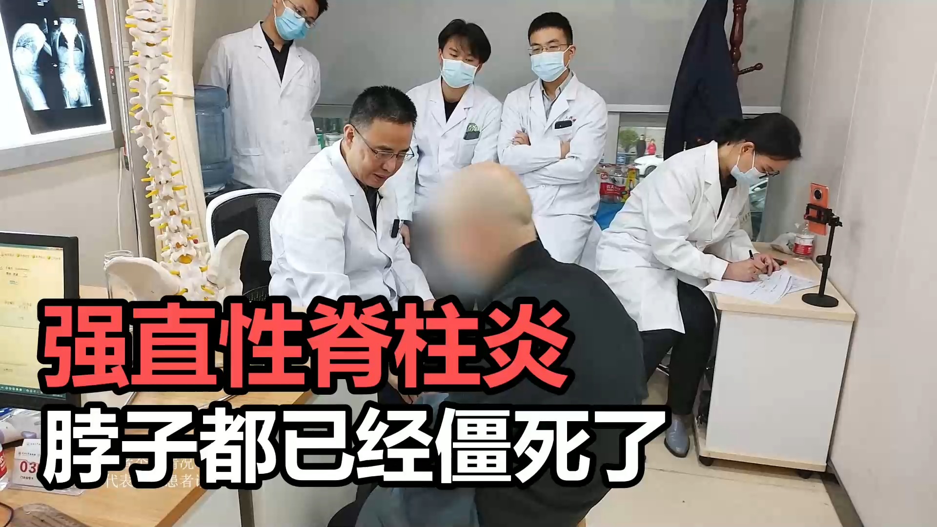 男子患强直性脊柱炎脖子都已经僵死了