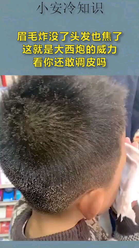 眉毛炸没了头发也焦了这就是大西炮的威力看你还敢调皮吗