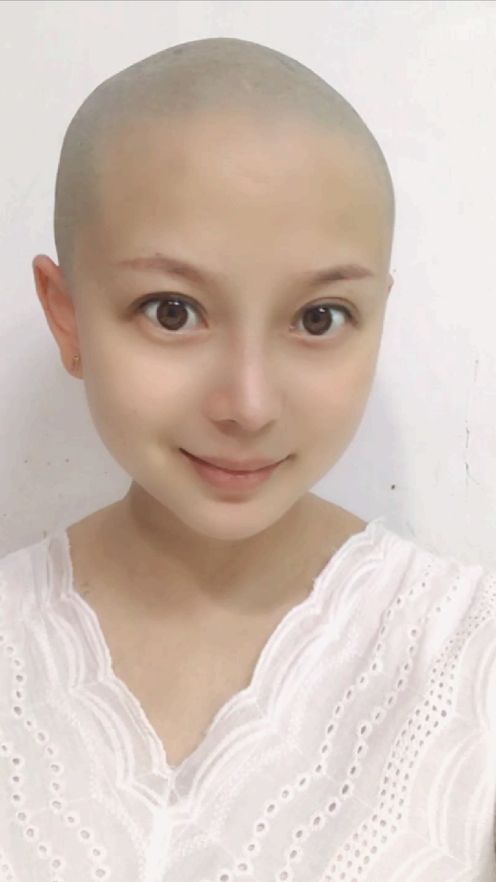 可爱到爆了#抓到一只光头小孕妇,你们有孕期剃光头的吗