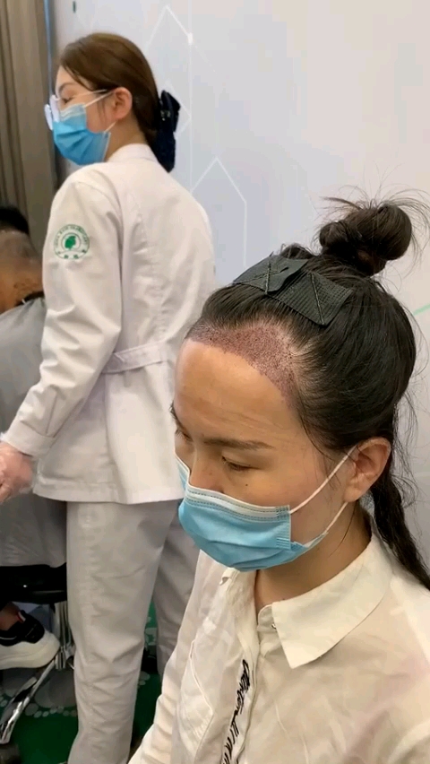 种发第二天,看着害怕,其实不疼的.从此告别单身和自卑!