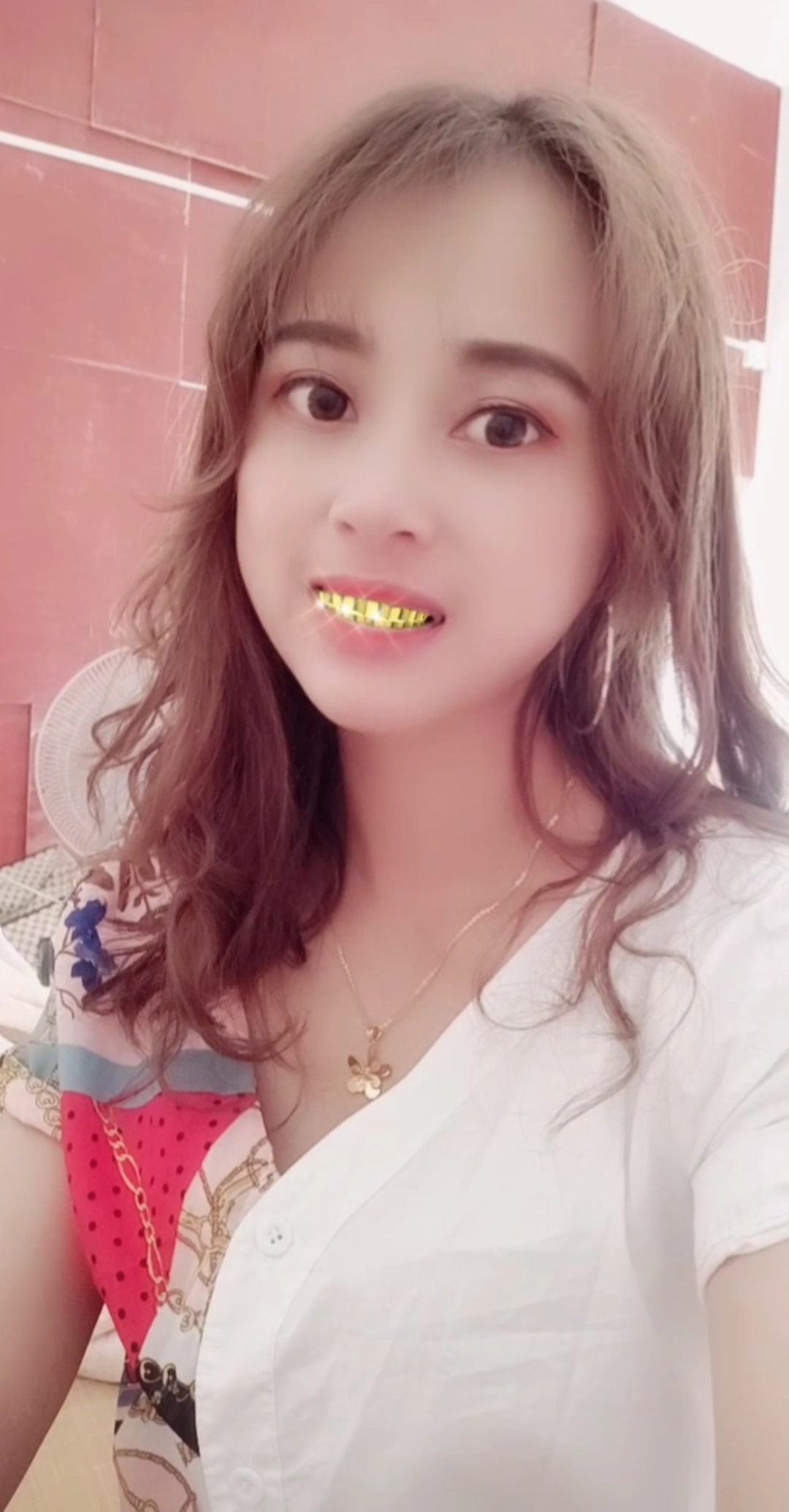 攒了几年的积蓄,终于去镶了一口金牙,还不敢大笑,就怕贼惦记-度小视