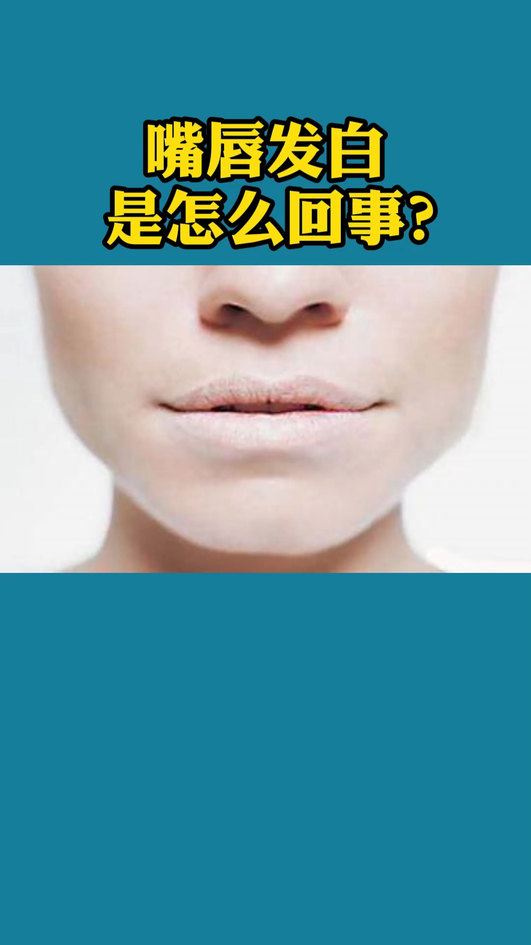 有嘴唇发白的情况是怎么回事?