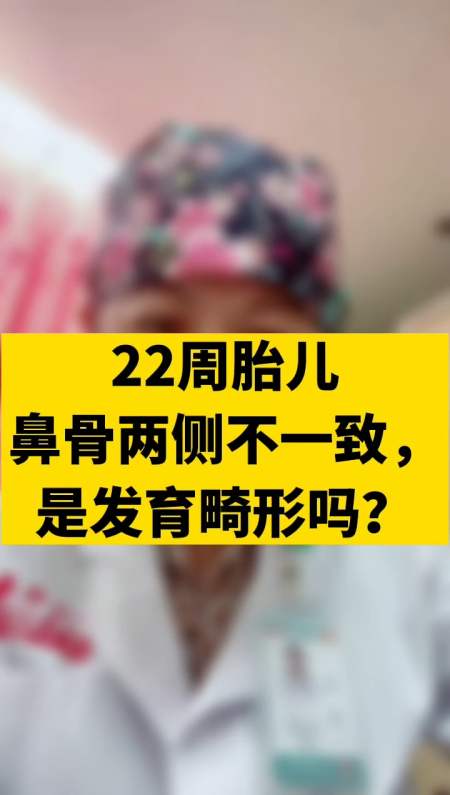 健康养生#22周胎儿鼻骨两侧不一致,是发育畸形吗?