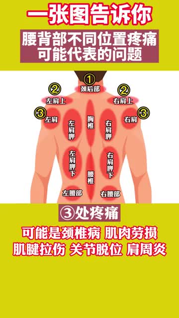 后背不同位置疼痛,可能疼痛问题不一样-度小视