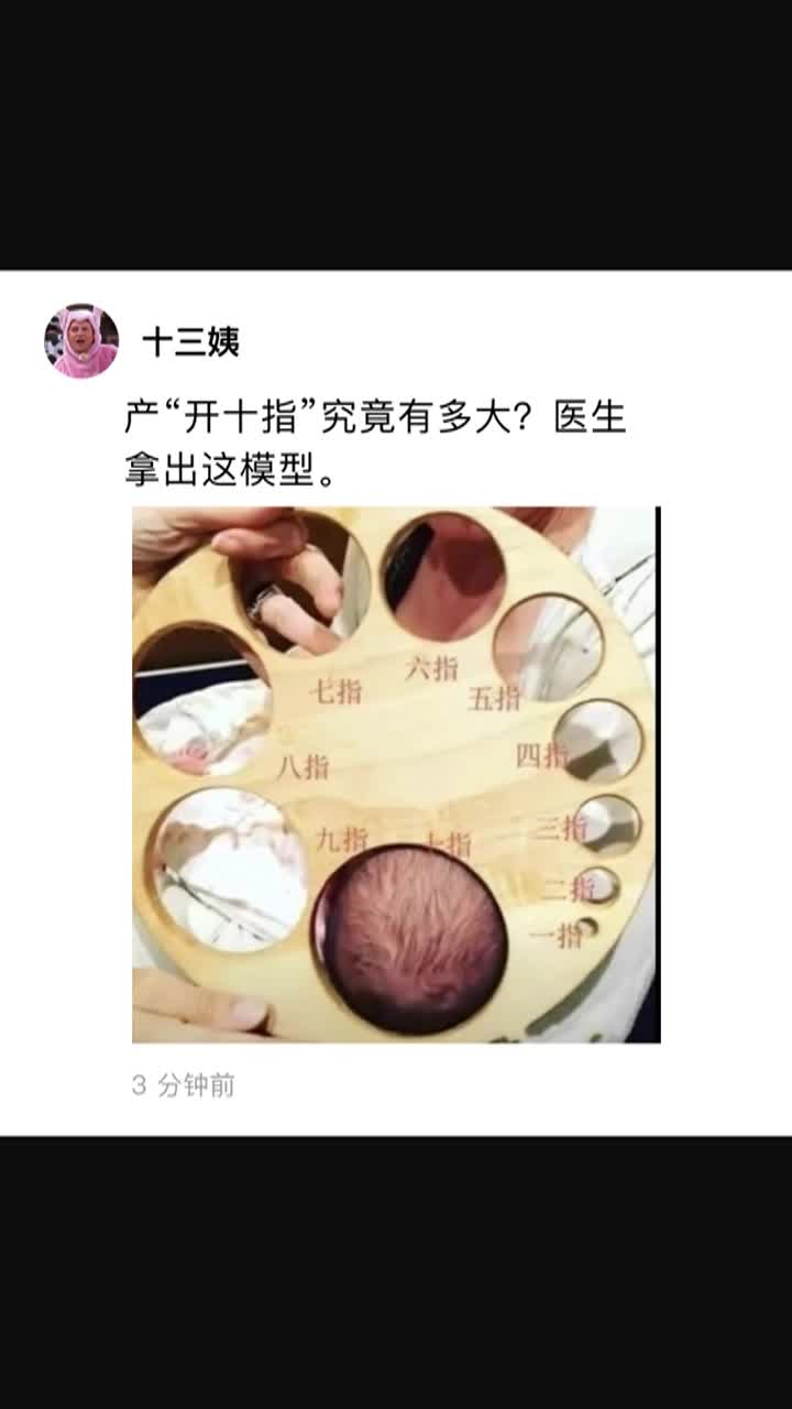 我要上热门#产"开十指"究竟有多大?医生拿出这模型