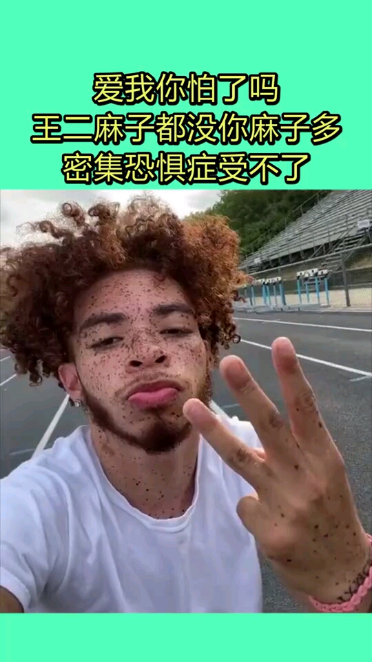 爱我你怕了吗,王二麻子都没你麻子多,密集恐惧症受不了!