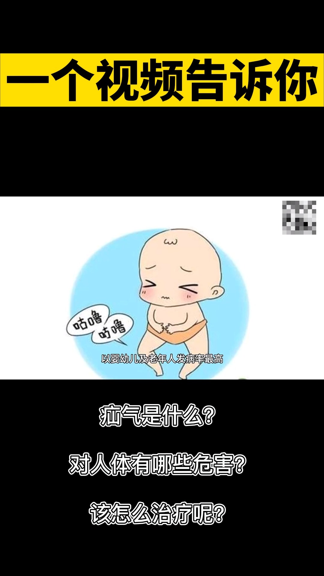 腹股沟疝气一个视频告诉你疝气是什么对人体有哪些危害该怎么治疗呢