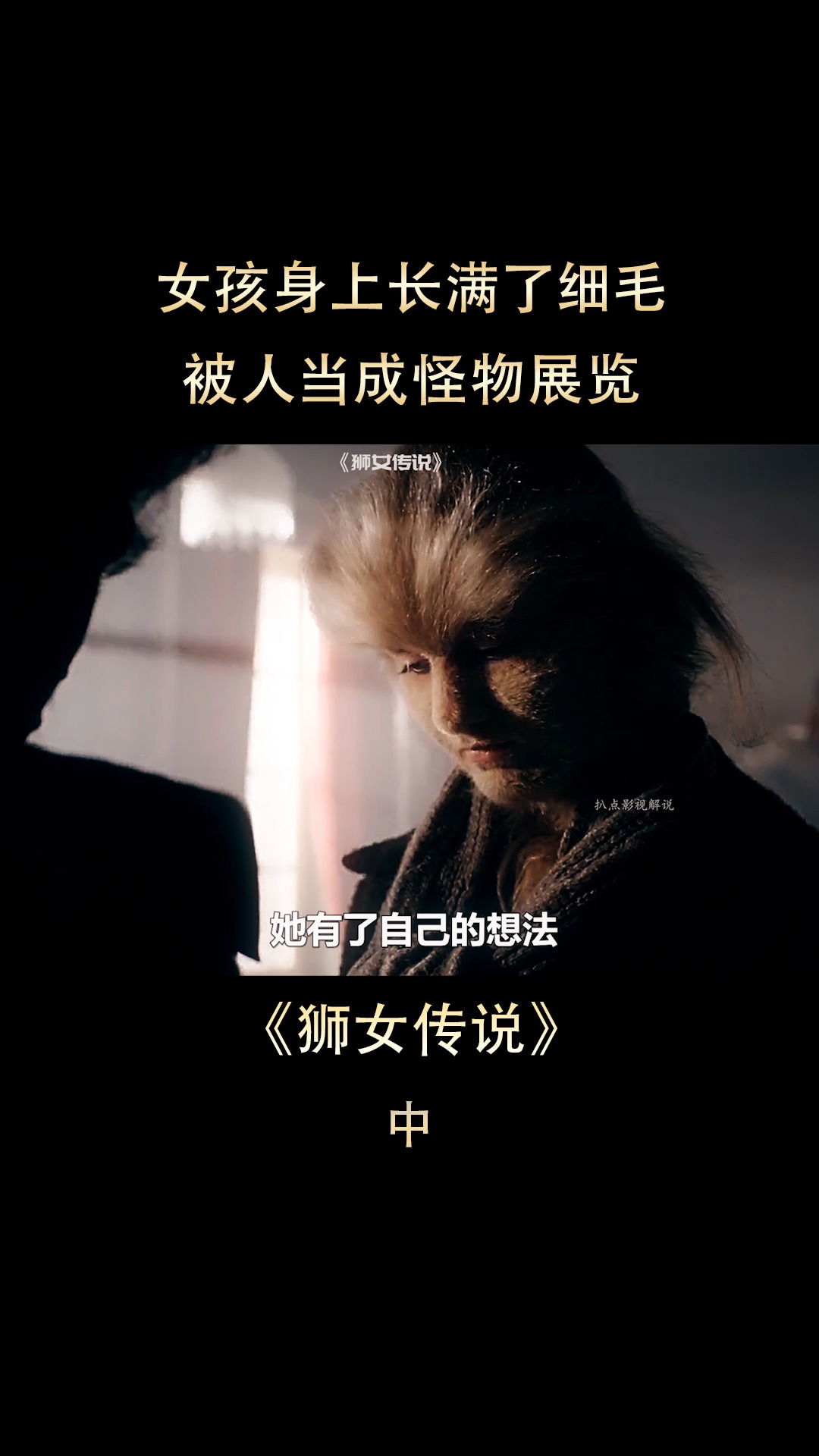 好看电影#女孩身上长满了细毛,被人当成怪物,最后却成了人生赢家