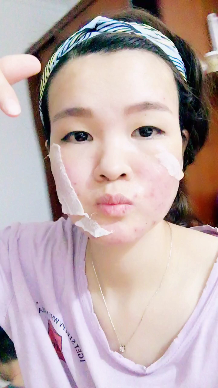 给皮肤排毒放血,这样皮肤会更好